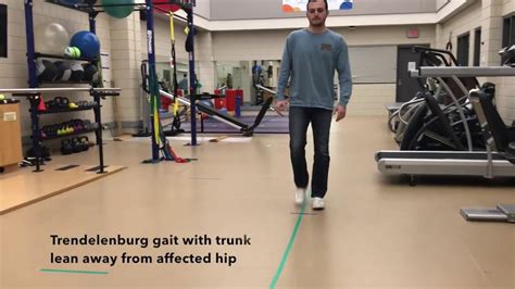 <b>Trendelenburg gait</b> is treatable with special shoes, orthotics, and exercises designed to strengthen the hip abductor muscles. . Compensated trendelenburg gait treatment